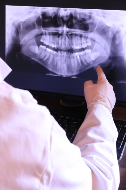 Best Emergency Treatment for Dental Infections or Abscesses in London, OH