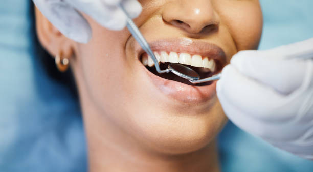 Best Emergency Treatment for Dental Infections or Abscesses in London, OH