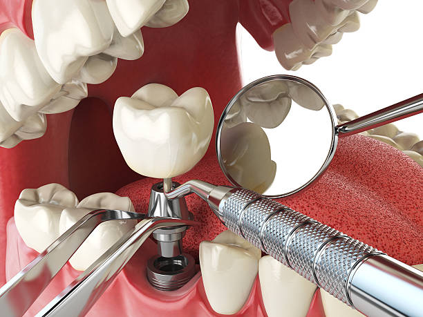Best Same-Day Emergency Dental Services in London, OH